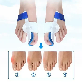 Haluksy bütykök Hallux Valgus lábujjszóró Bigfoot hüvelykujj everzió ortopédia lábujj szóró lábujj elválasztó lábujj ápoló korrektor